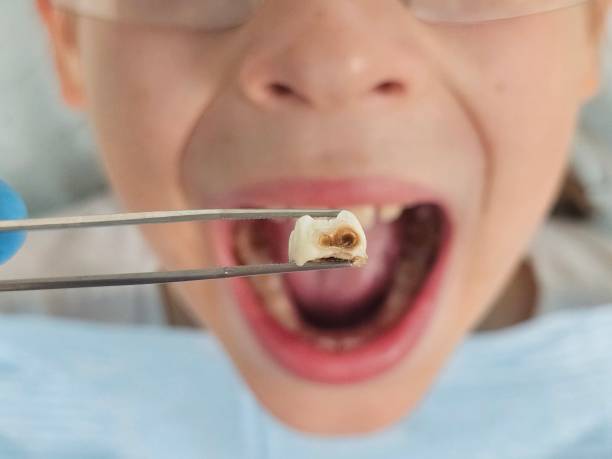 Best Holiday Emergency Dentist in Calverton Park, MO